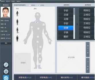 北京天地智慧醫(yī)療設(shè)備DR平臺界面設(shè)計